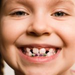 Cauza pentru dinti lipsa la copii