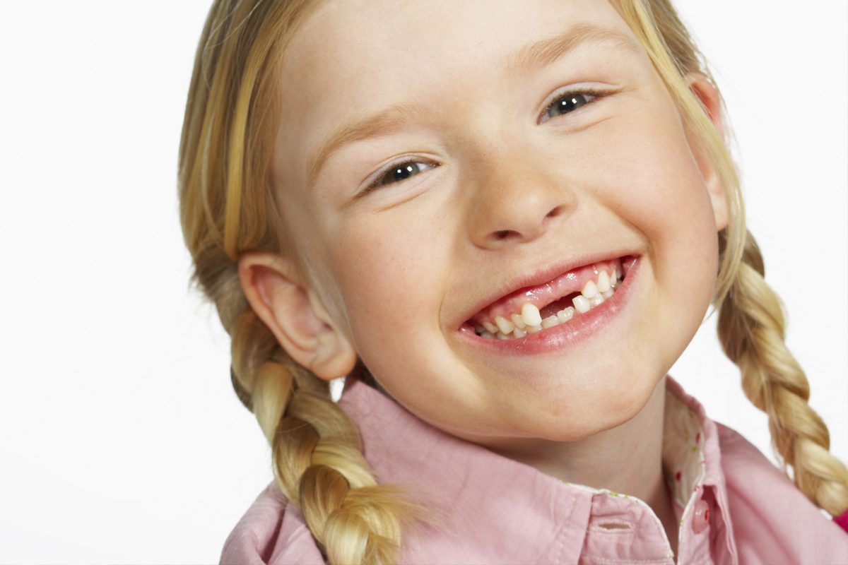 Traumatismul dento-alveolar si alte accidente dentare la copii