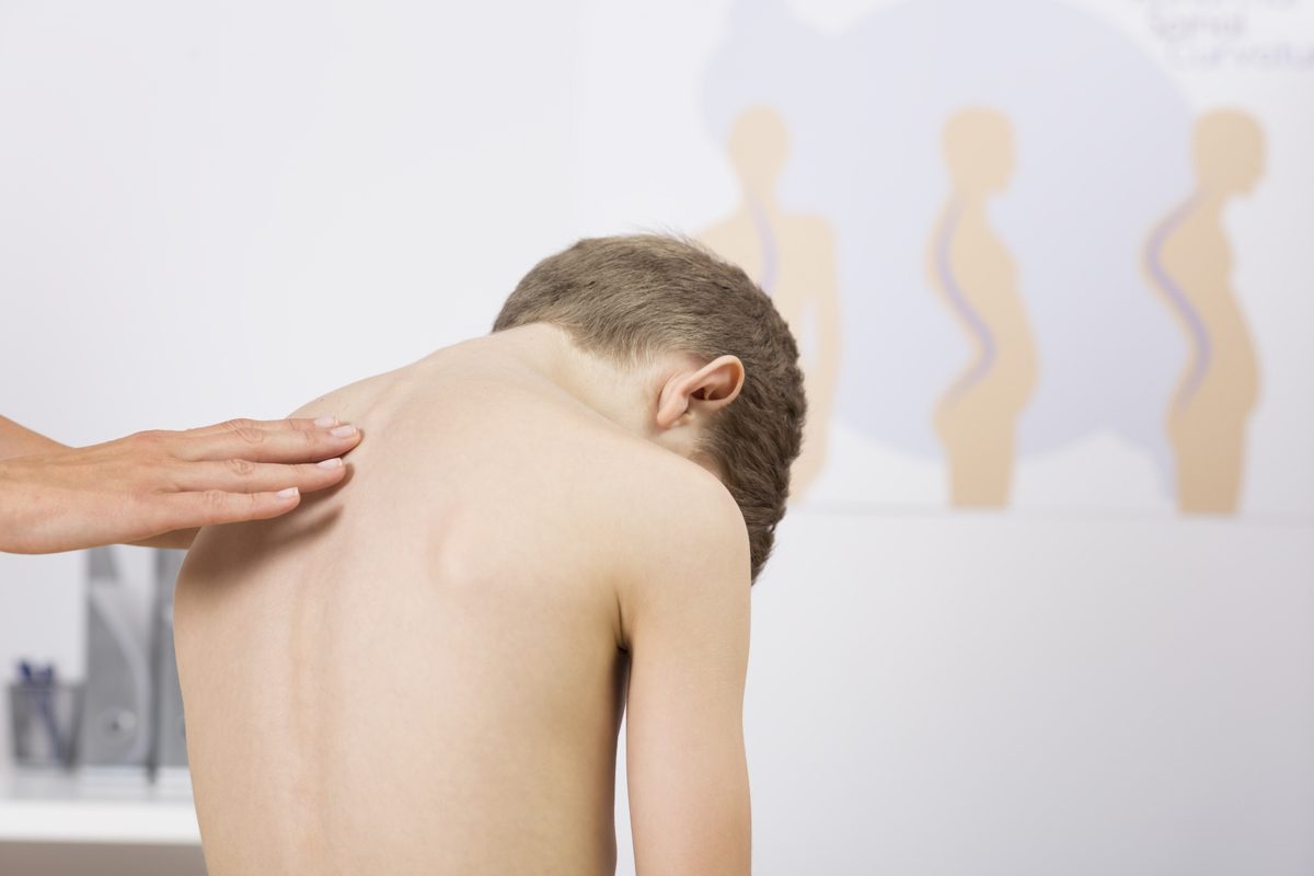 Scolioza la copii: De la diagnostic la tratament