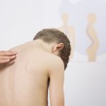 Scolioza la copii: De la diagnostic la tratament