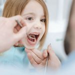 La ce foloseste sigilarea dintilor la copii