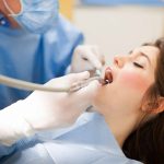 Situatiile care impun un implant dentar